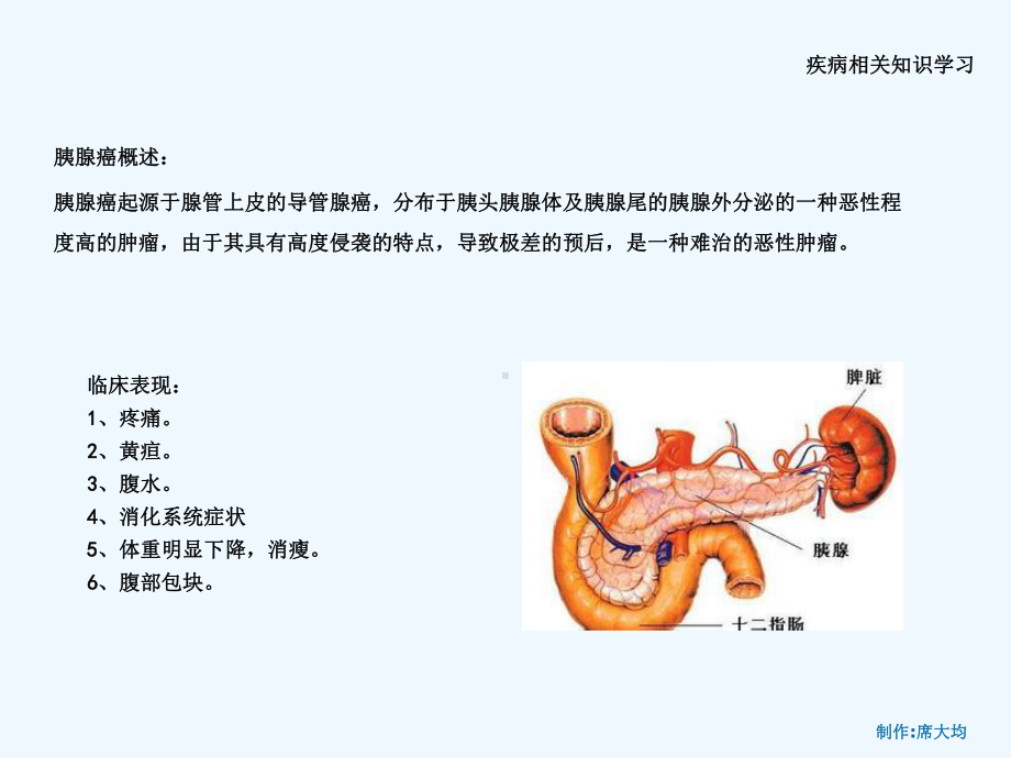 胰腺恶性肿瘤病人护理查房课件.ppt_第3页