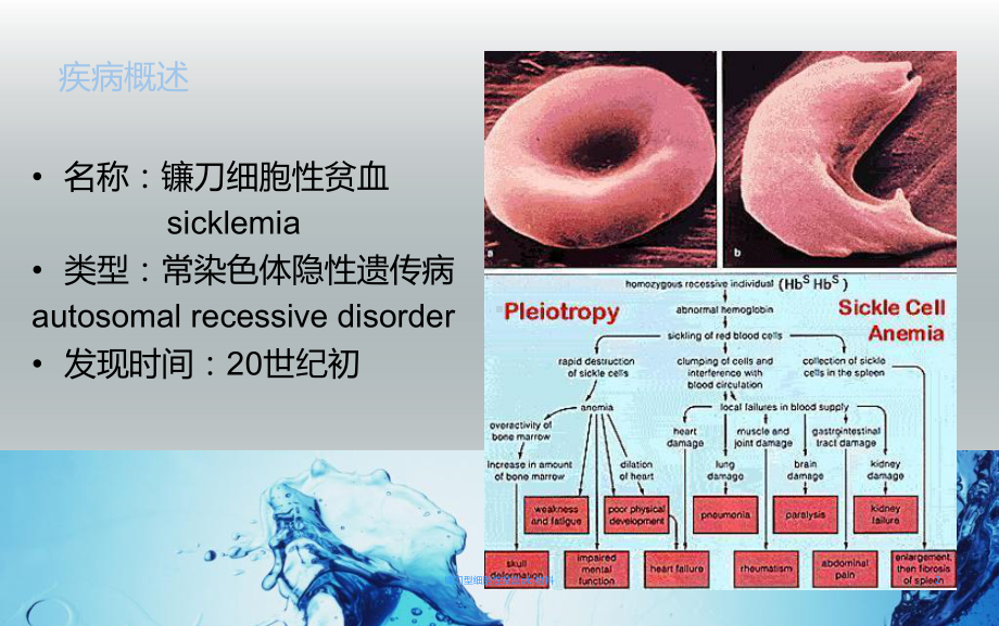 镰刀型细胞性贫血pbl材料课件.ppt_第2页