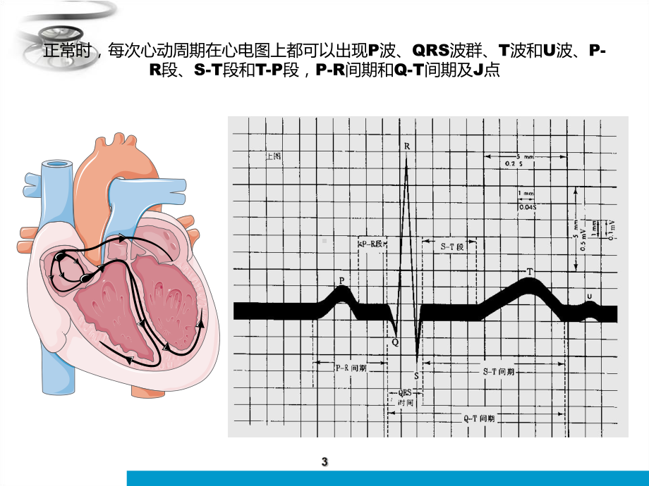 心电图的判读课件.ppt_第3页