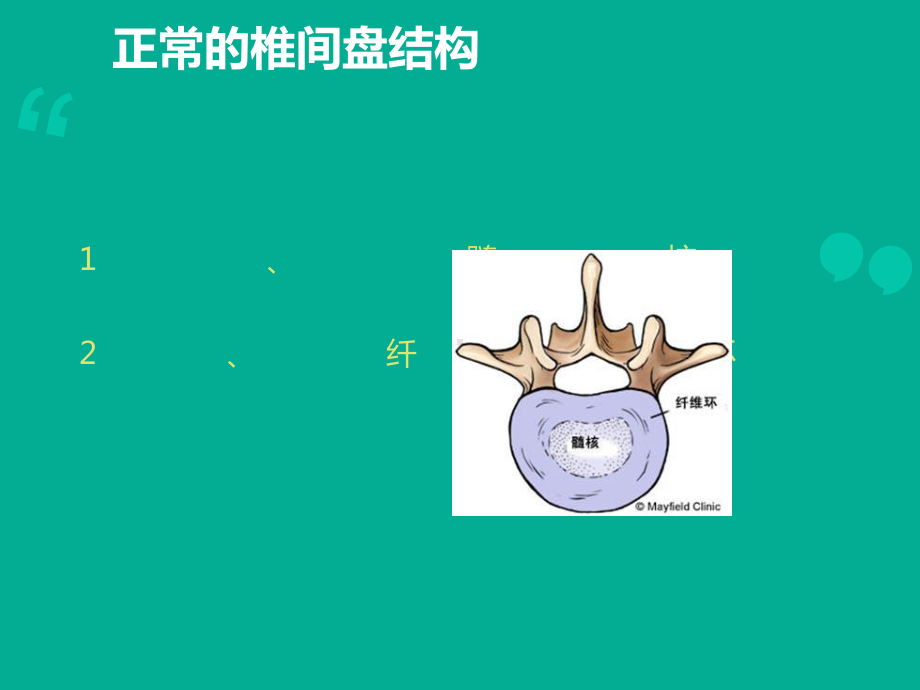 腰腿痛颈肩痛病人的护理课件.ppt_第2页