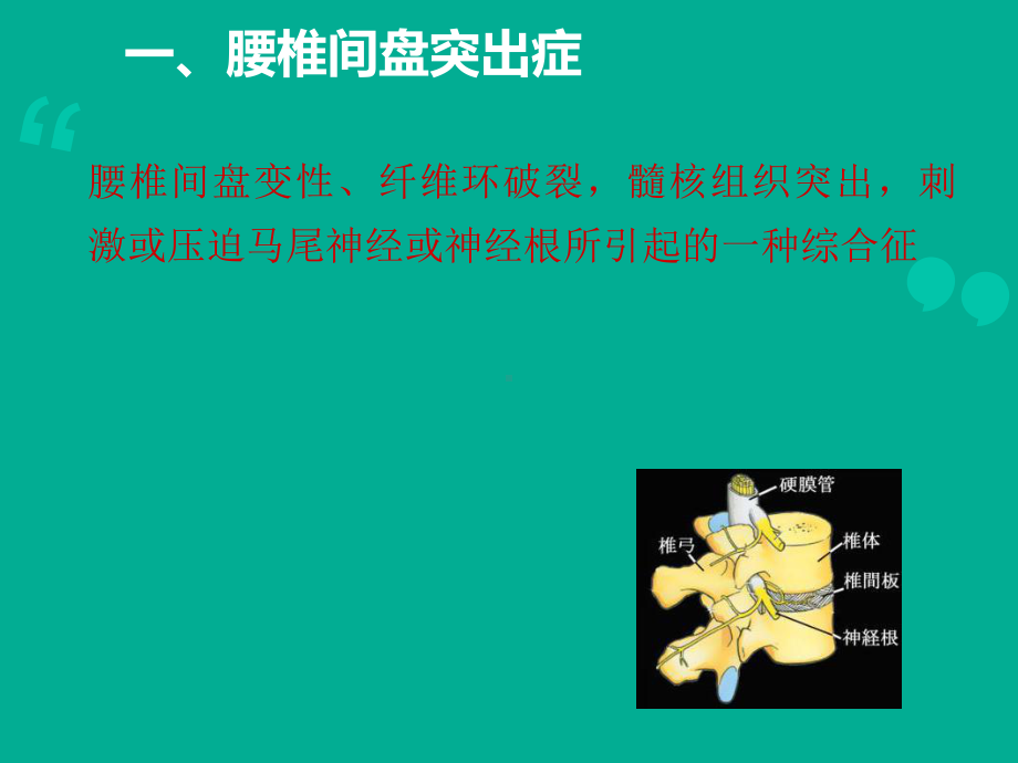 腰腿痛颈肩痛病人的护理课件.ppt_第3页