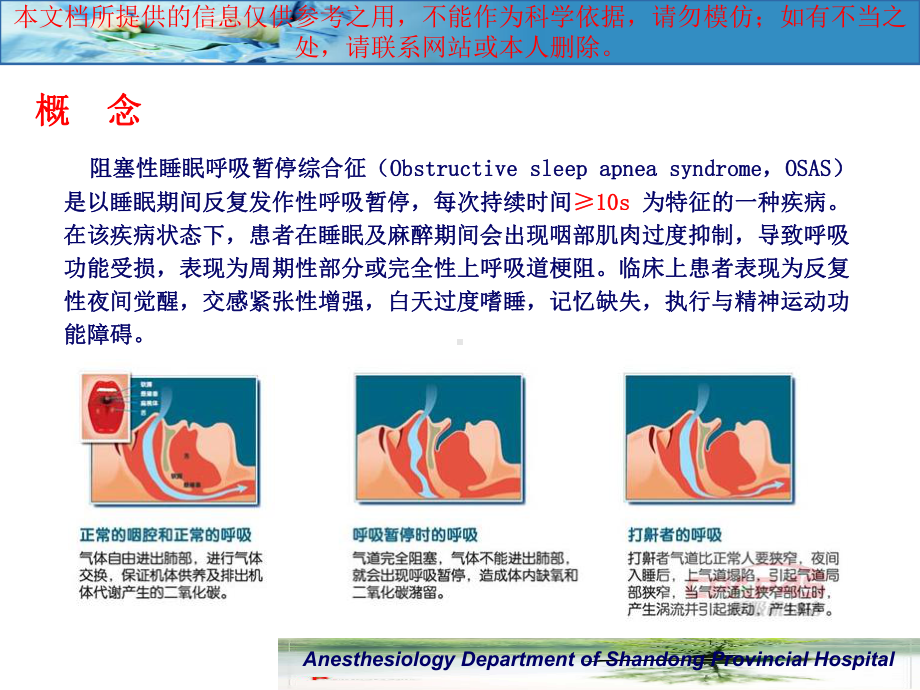 阻塞性睡眠呼吸暂停综合征患者的麻醉管理培训课件.ppt_第1页