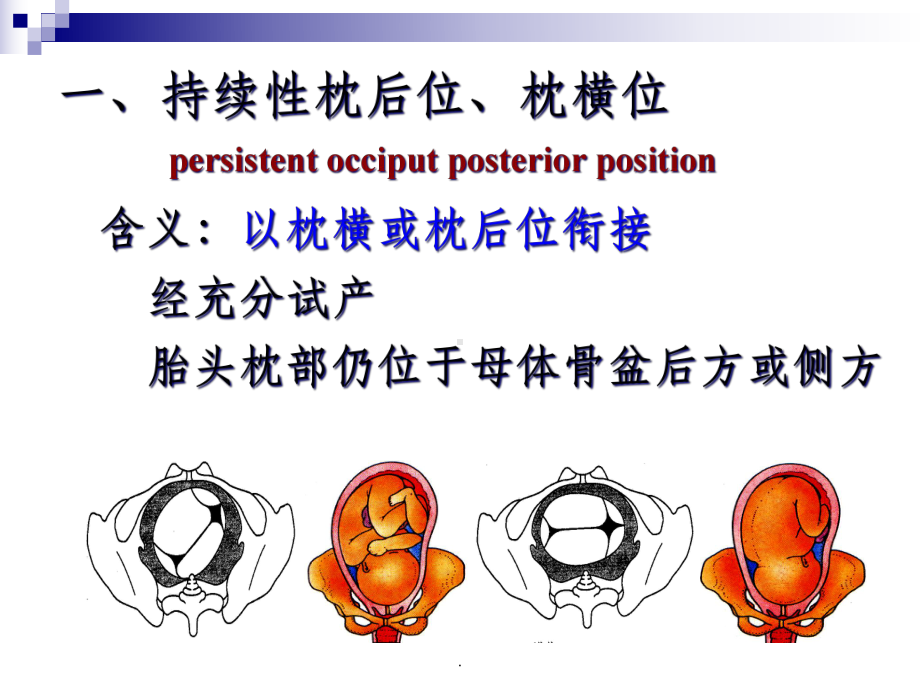 胎位异常教案课件.ppt_第3页