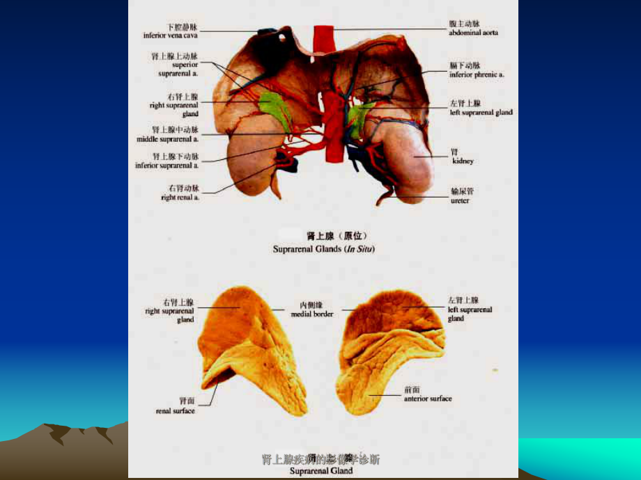 肾上腺疾病的影像学诊断课件.ppt_第3页