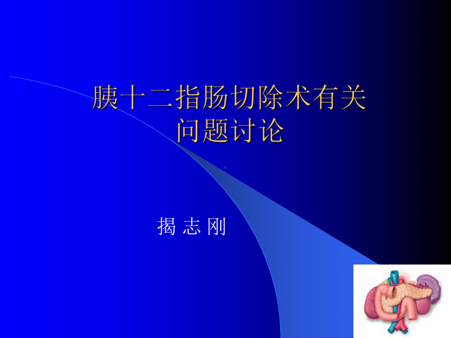 胰十二指肠切除术有关问题讨论课件.pptx_第1页