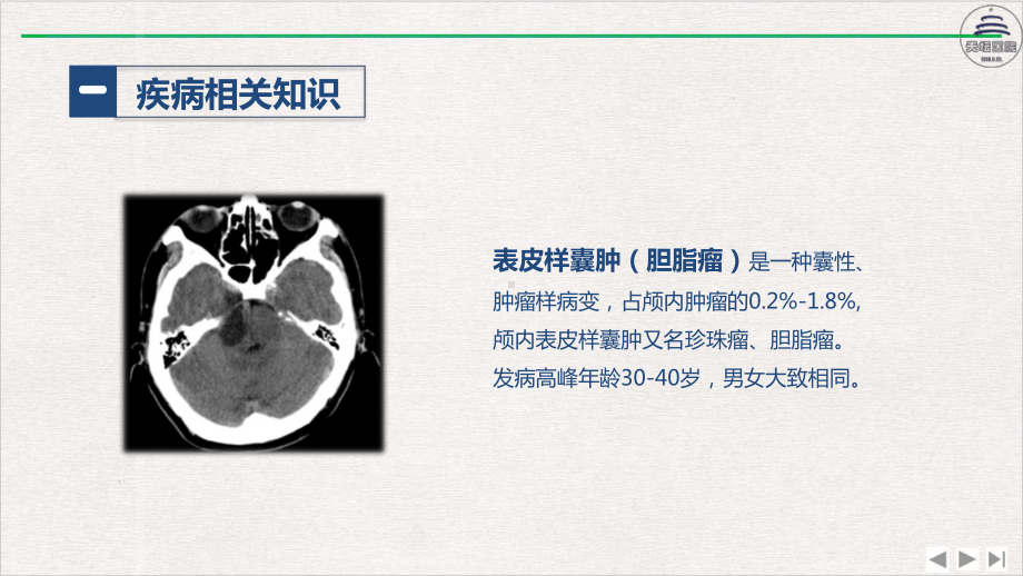 颅内表皮样囊肿患者的护理查房优选课件.pptx_第3页