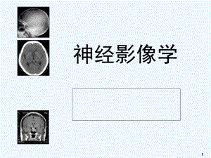 神经影像学-课件.ppt