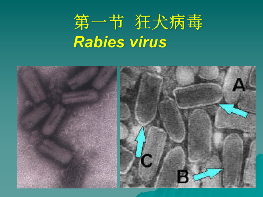 护理微生物学第二十三章其他病毒及朊粒课件.ppt_第3页