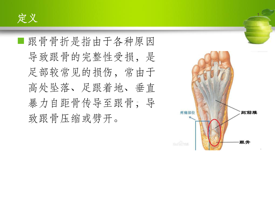 跟骨骨折护理查房课件-2.ppt_第2页