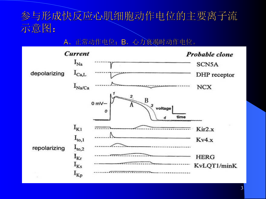 长QT综合征学习课件.ppt_第3页