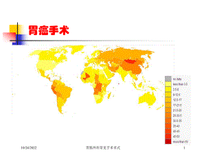 胃肠外科常见手术术式培训课件.ppt