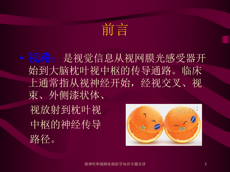 视神经和视路疾病医学知识专题宣讲培训课件.ppt_第3页