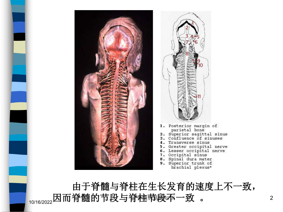 脊髓病基础知识培训课件.ppt_第2页