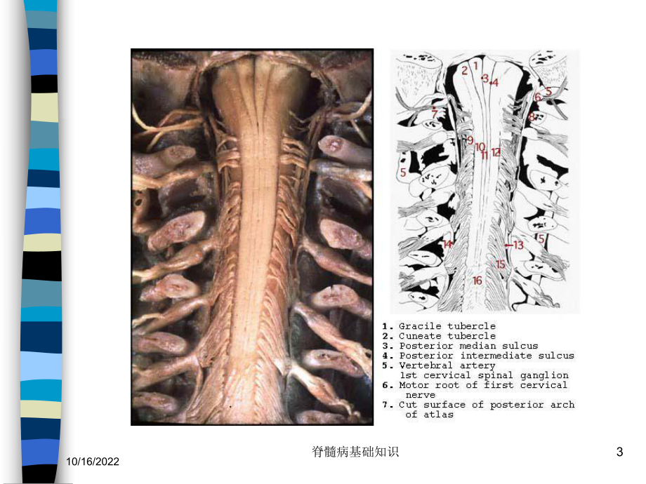 脊髓病基础知识培训课件.ppt_第3页