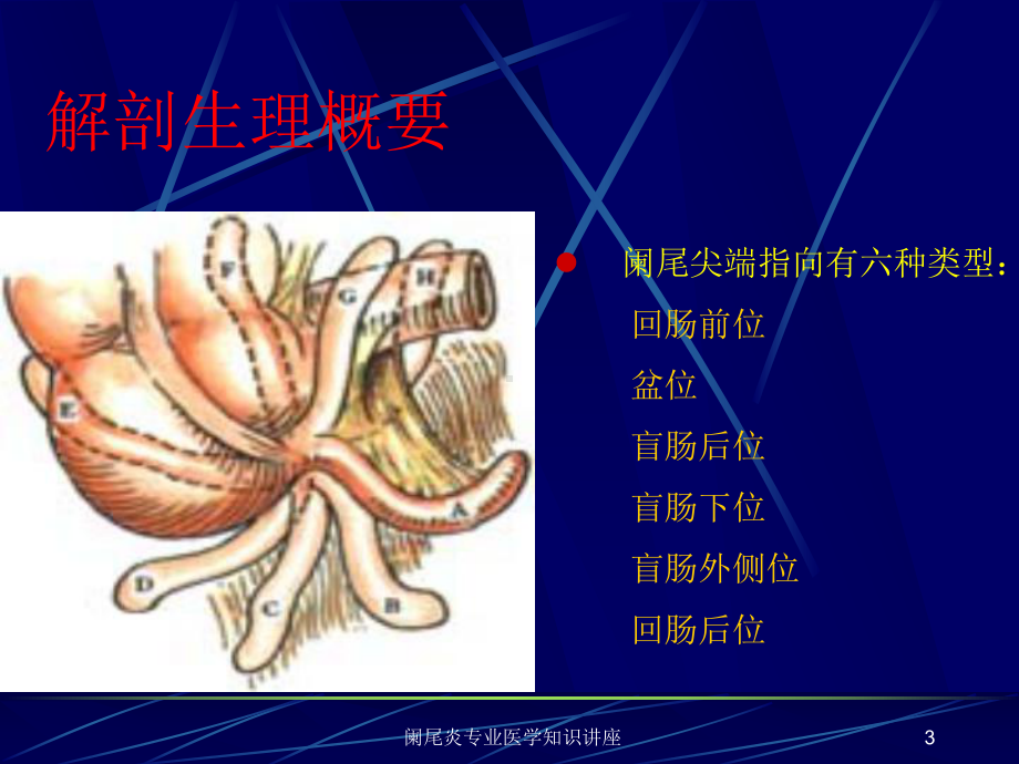 阑尾炎专业医学知识讲座培训课件.ppt_第3页