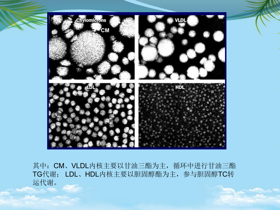 血脂构成及形成机理高血脂症机理及靶点归纳最全课件.ppt_第3页