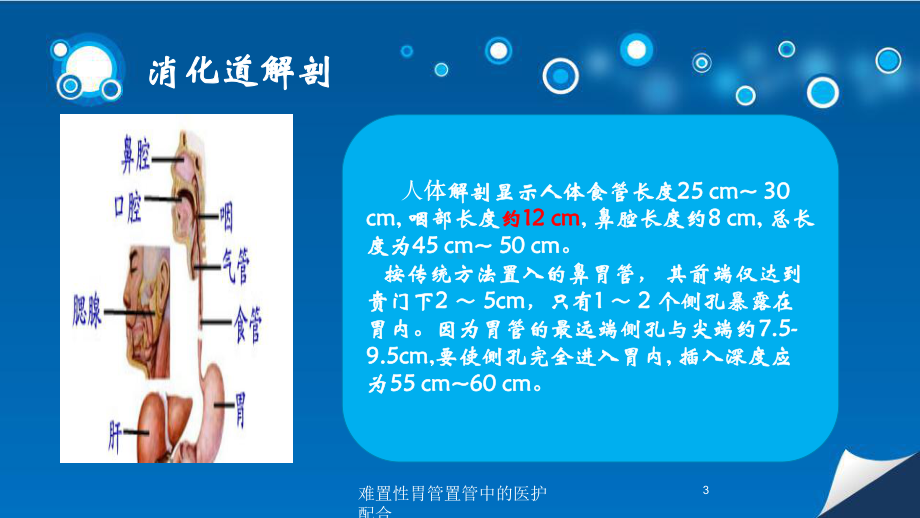 难置性胃管置管中的医护配合培训课件.ppt_第3页