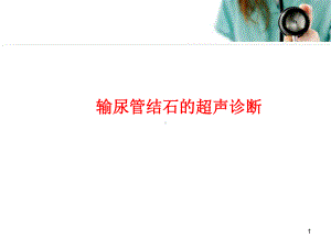 输尿管结石的超声诊断学习课件.ppt