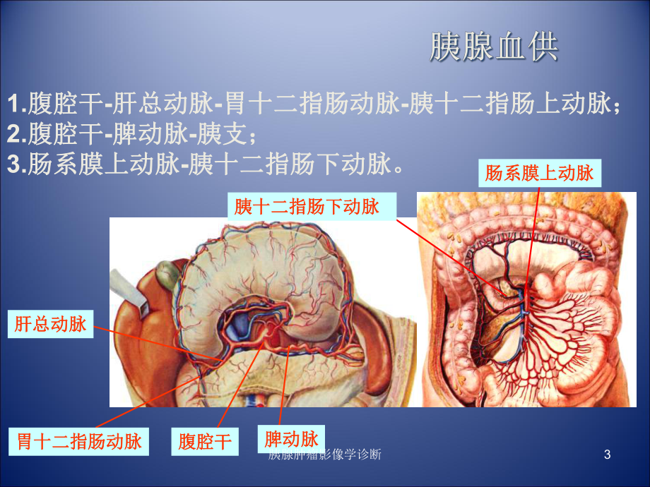 胰腺肿瘤影像学诊断培训课件.ppt_第3页