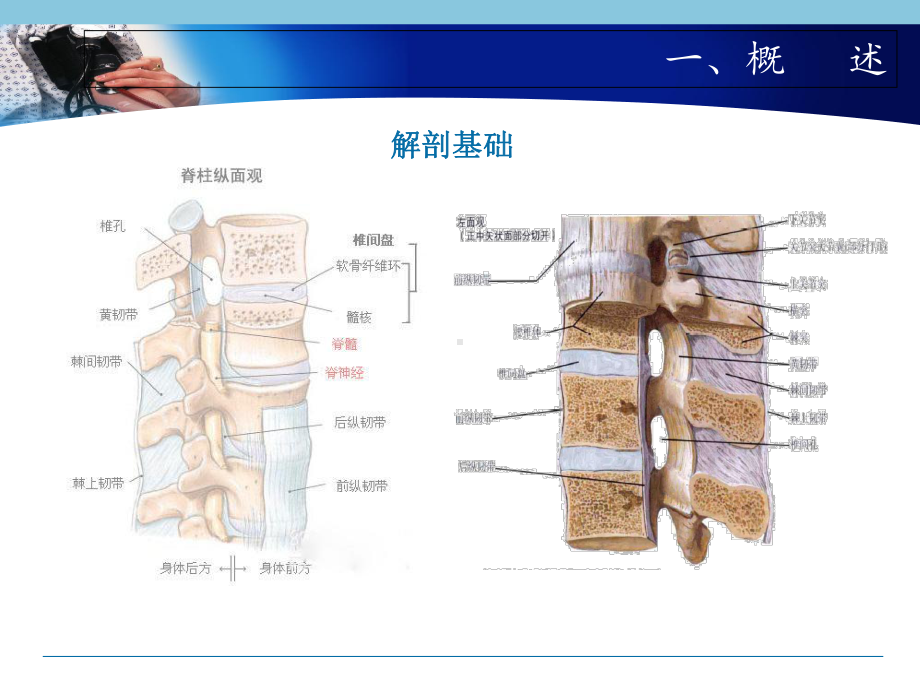 腰椎间盘突出康复主题讲座课件.ppt_第2页