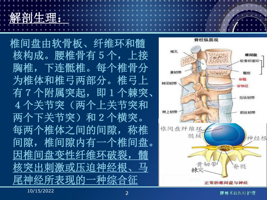 腰椎术后医疗护理培训课件.ppt_第2页