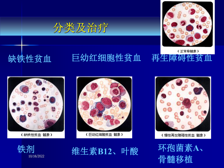 血液系统疾病的临床用药课件-2.ppt_第3页