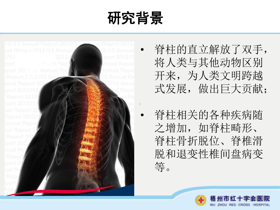 数字化虚拟技术在脊柱椎弓根内固定系统的应用研究课件.ppt_第3页