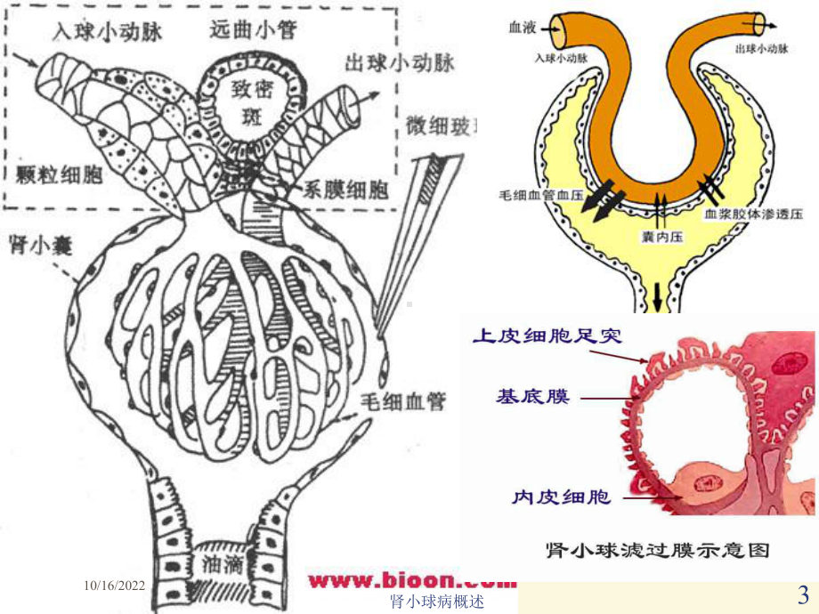 肾小球病概述培训课件.ppt_第3页