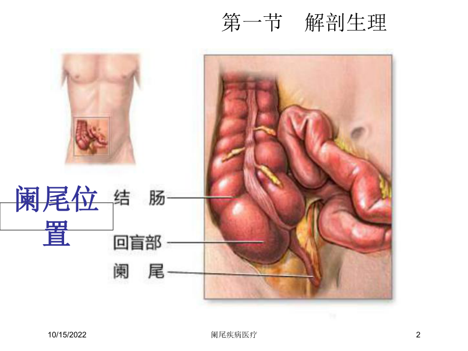 阑尾疾病医疗培训课件.ppt_第2页