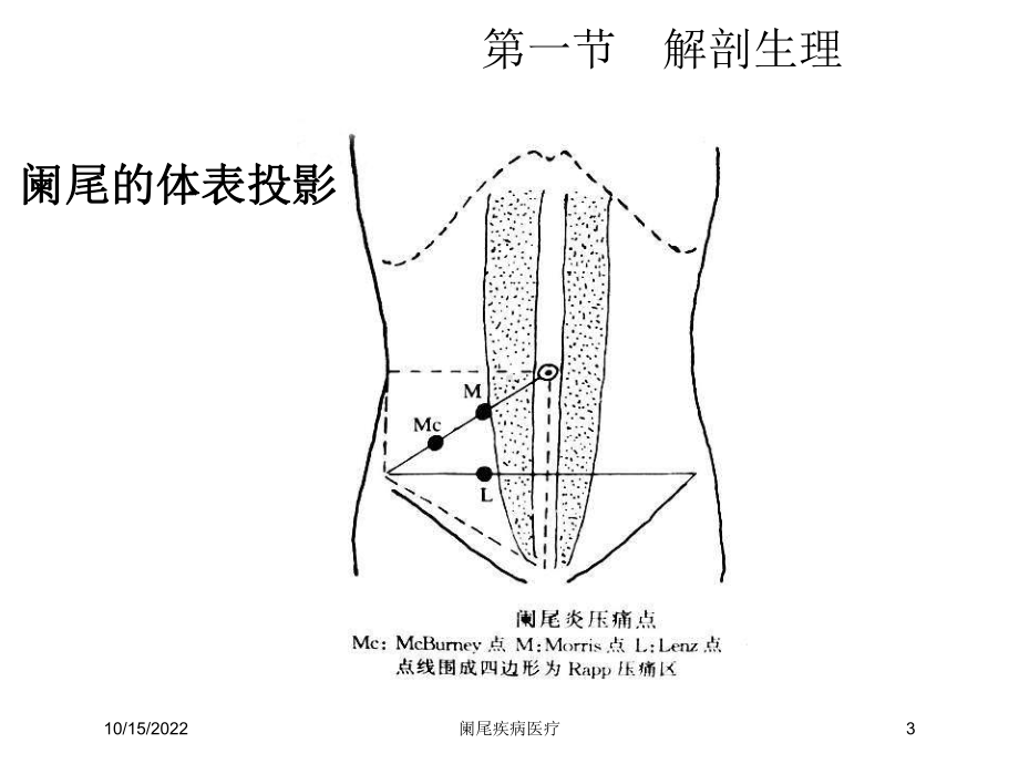 阑尾疾病医疗培训课件.ppt_第3页