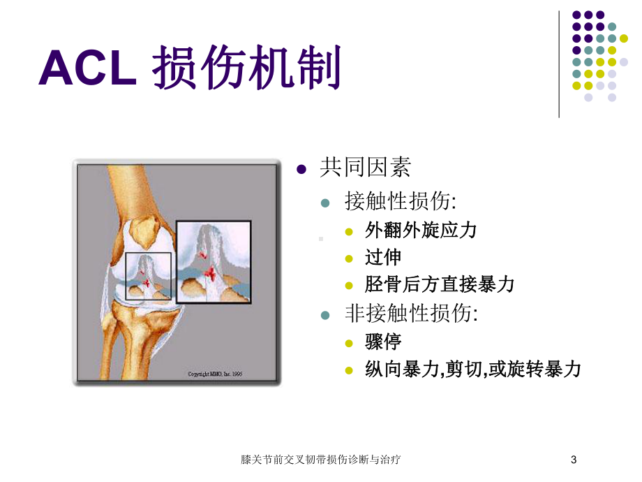 膝关节前交叉韧带损伤诊断与治疗培训课件.ppt_第3页