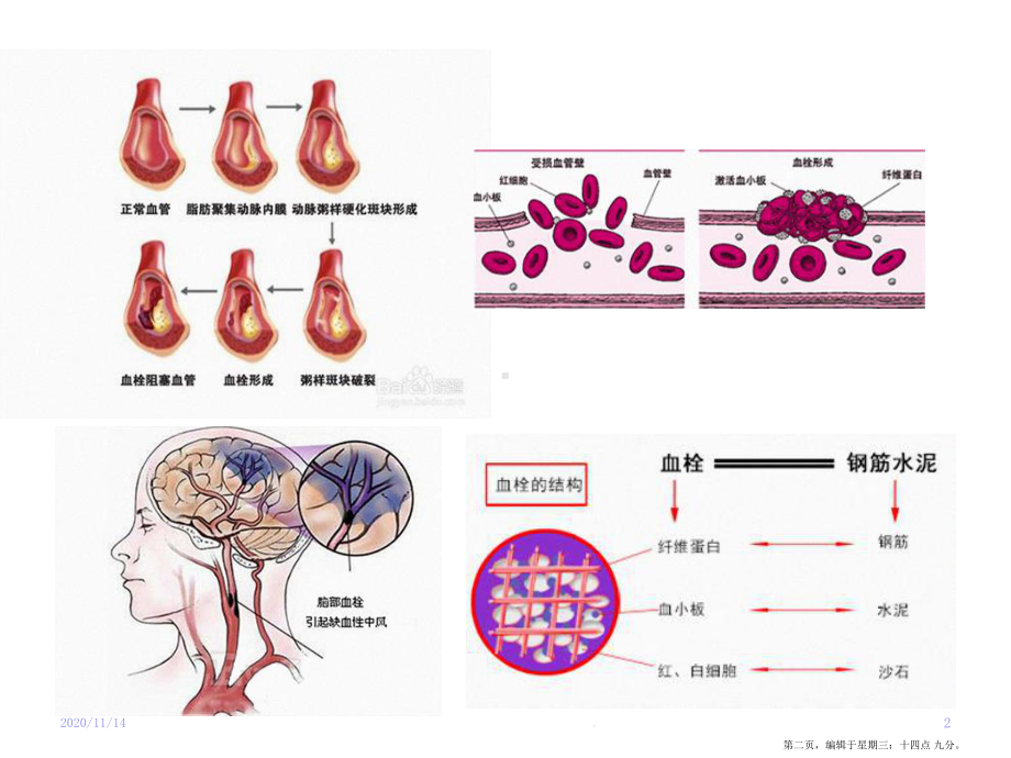 血栓形成与溶栓基本知识大略复习课件.ppt_第2页