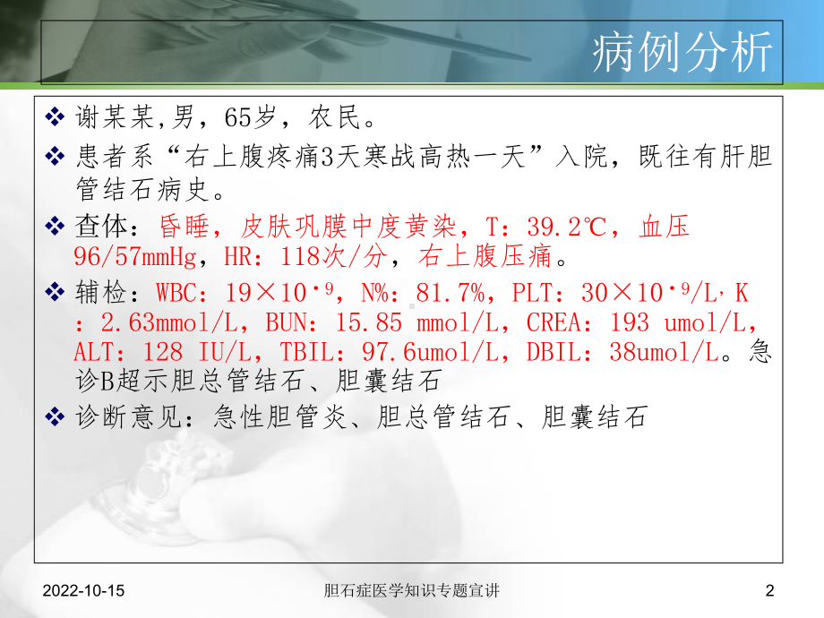 胆石症医学知识专题宣讲培训课件.ppt_第2页