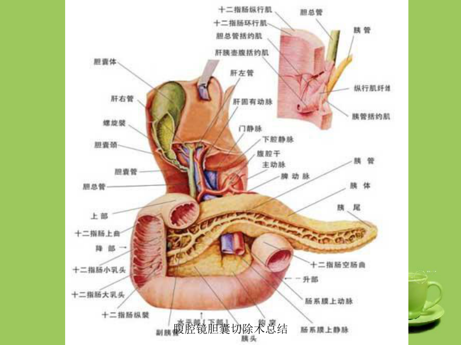 腹腔镜胆囊切除术总结培训课件.ppt_第2页