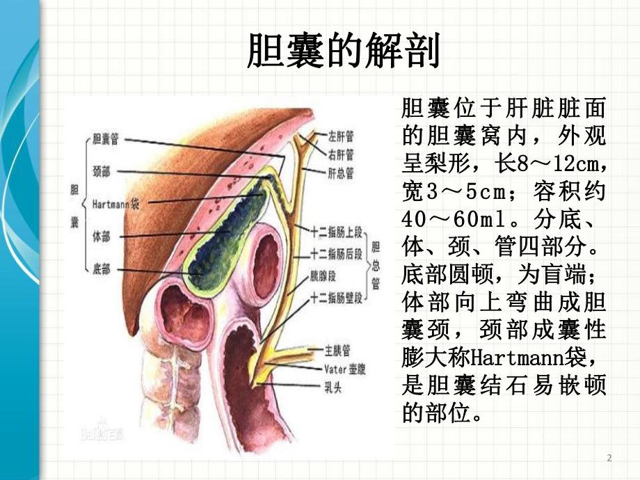 腹腔镜胆囊切除术护理查房课件.pptx_第2页