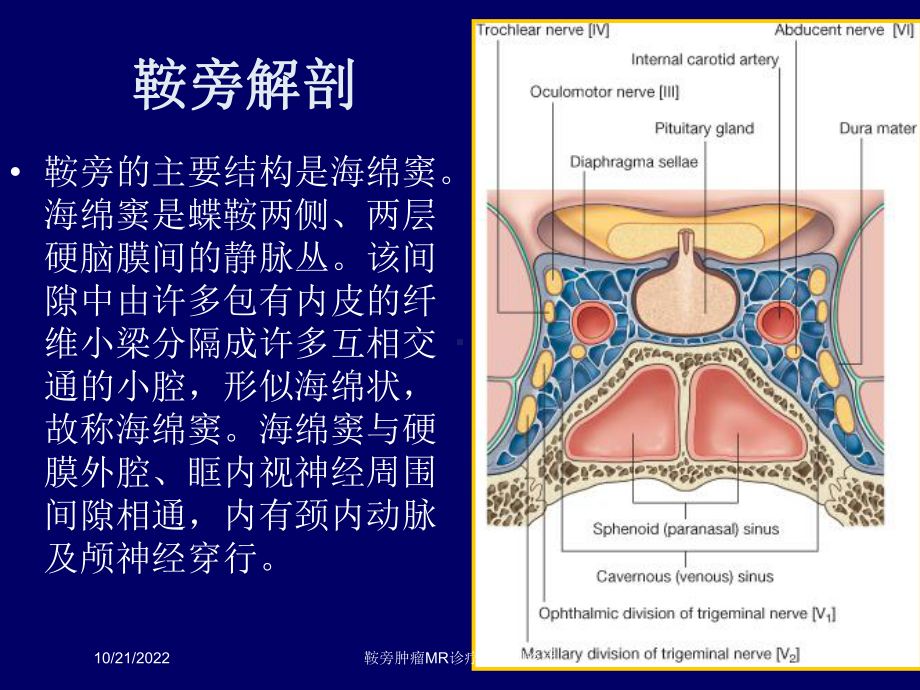 鞍旁肿瘤MR诊疗和鉴别诊疗培训课件.ppt_第1页