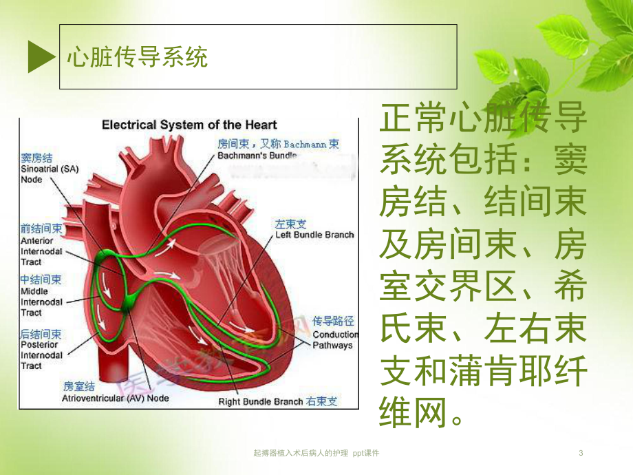 起搏器植入术后病人的护理-课件.ppt_第3页