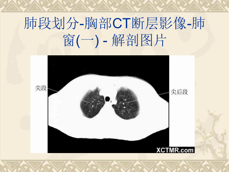 胸上腹和盆腔CT详细实用图解课件.ppt_第3页