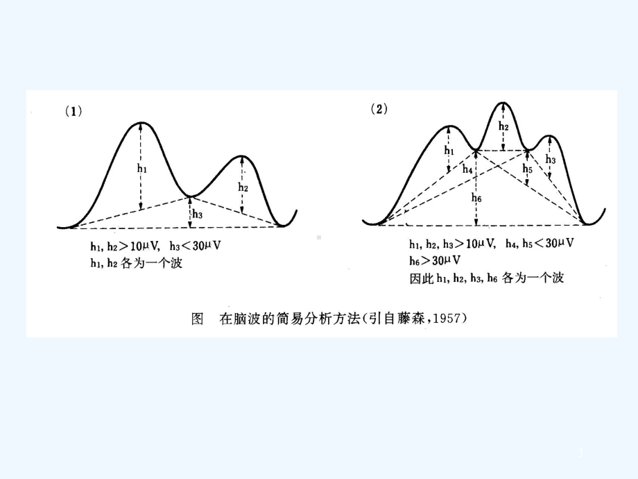 脑电图基本知识-课件.ppt_第3页