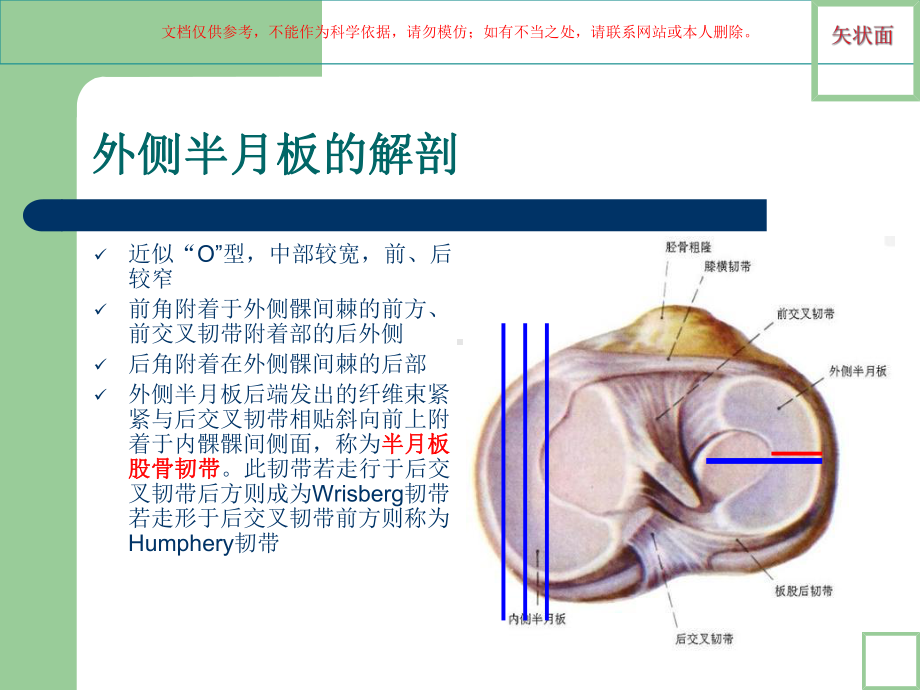 膝关节半月板损伤MRI诊疗培训课件.ppt_第2页