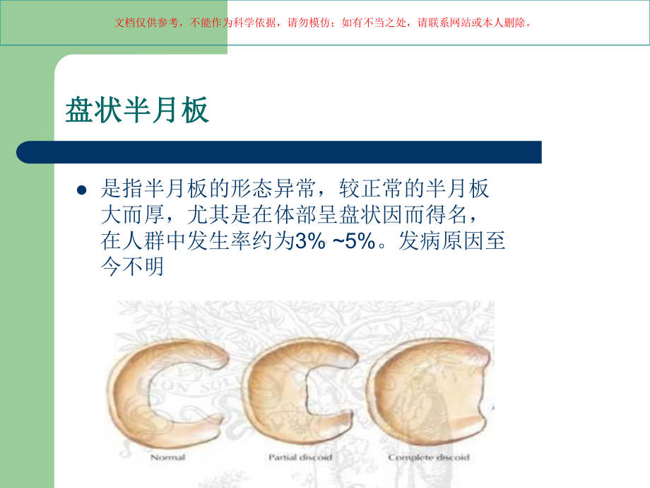 膝关节半月板损伤MRI诊疗培训课件.ppt_第3页