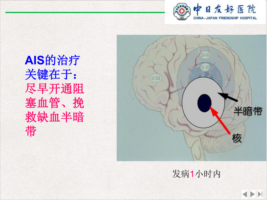 静脉溶栓的护理课件完整版.pptx_第2页