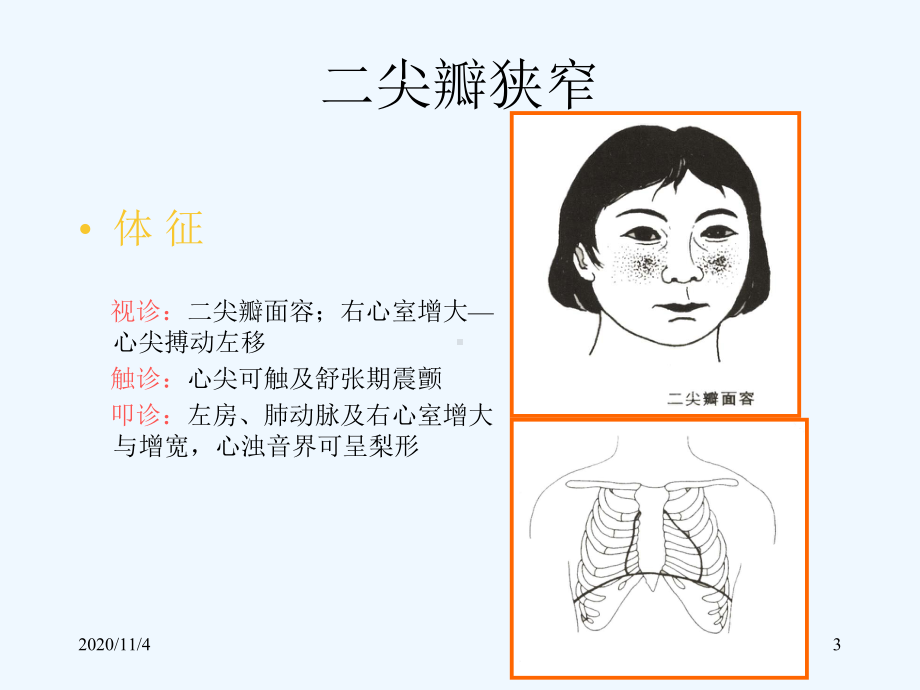 诊断学循环系统常见疾病课件.ppt_第3页