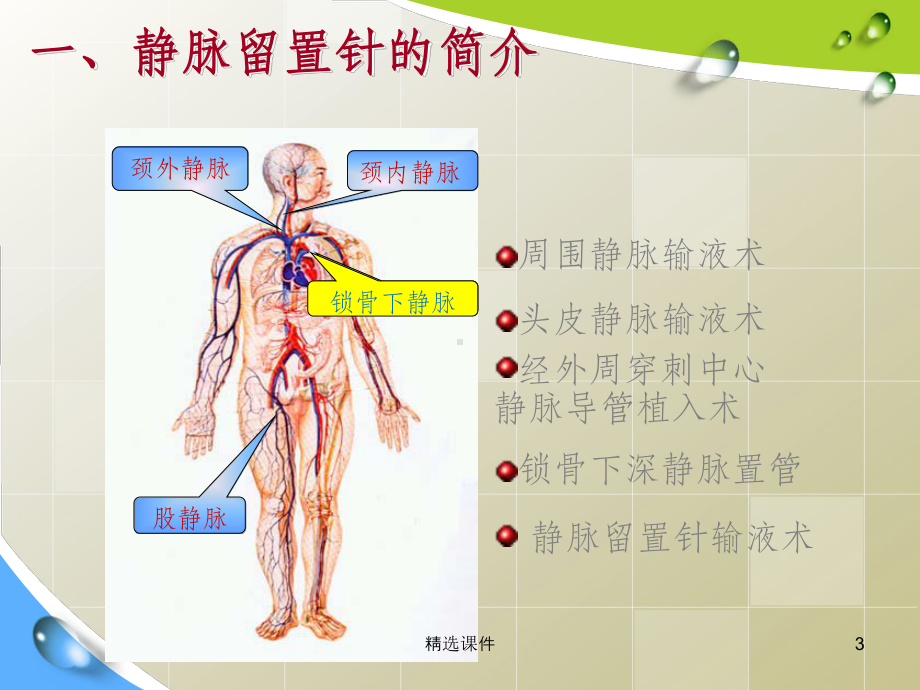 静脉留置针常见并发症预防及护理85758课件.ppt_第3页