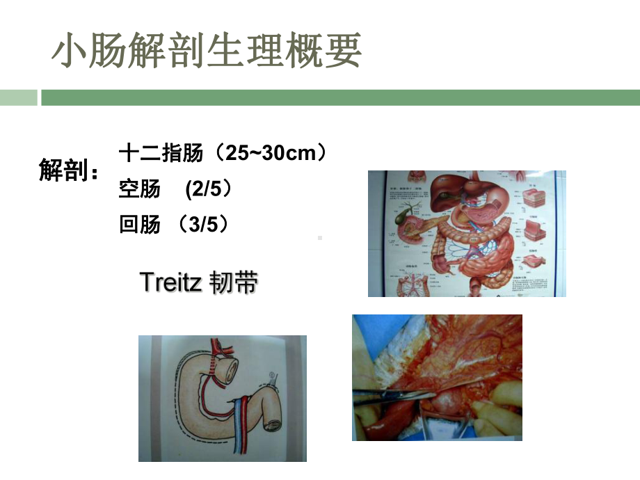 小肠疾病-协和结直肠课件.ppt_第3页