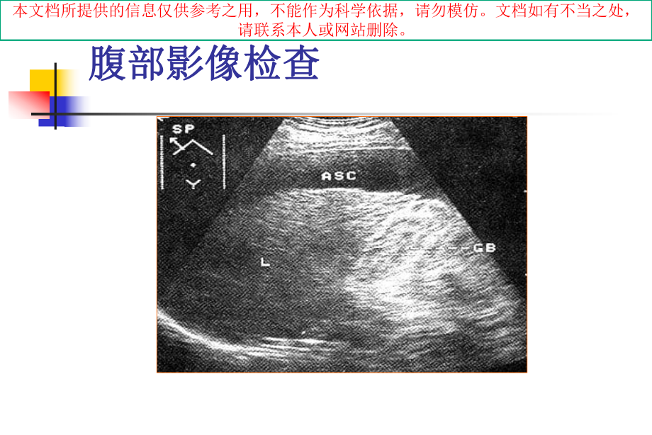 腹水的诊断以鉴别诊断培训课件.ppt_第2页