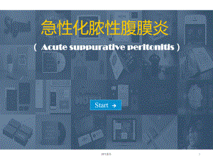 急性化脓性腹膜炎-课件.ppt