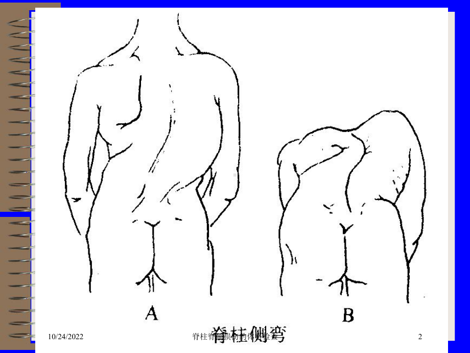 脊柱脊髓损伤的体格检查培训课件.ppt_第2页