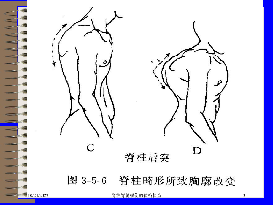 脊柱脊髓损伤的体格检查培训课件.ppt_第3页