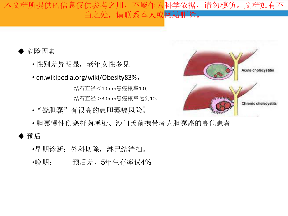 胆囊癌CT诊疗培训课件.ppt_第2页